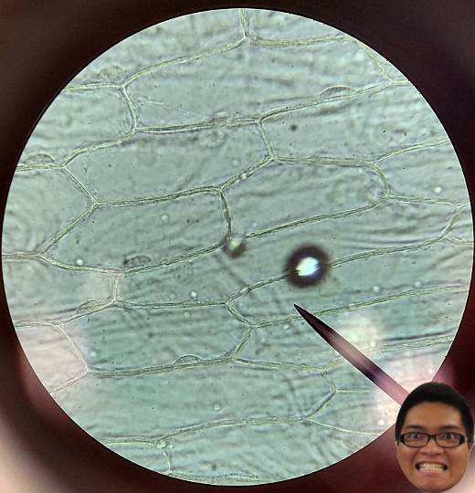 onion cells under microscope high power